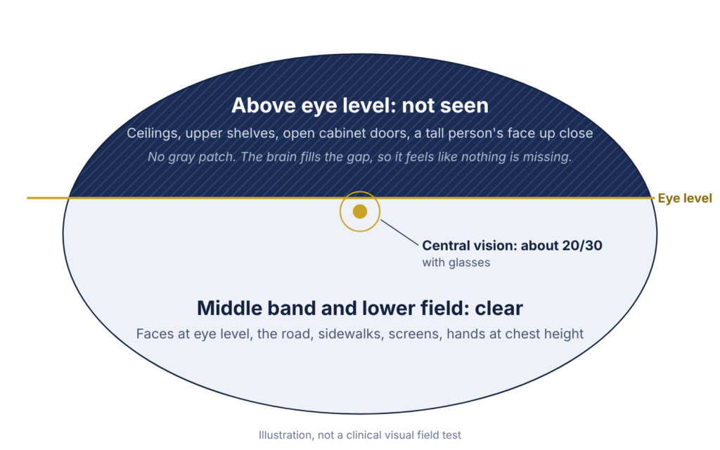 A wide oval representing my visual field. The top portion, above a gold eye-level line, is dark and labeled not seen. A gold dot just below the line marks central vision of about 20/30 with glasses. The lower portion is light and labeled clear.